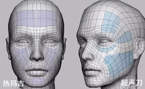 超声刀跟热玛吉有什么区别？超声刀美容一次多少钱？