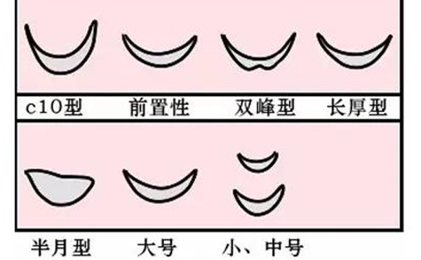 垫下巴整形多少钱？垫下巴手术的价格受什么因素有哪些？