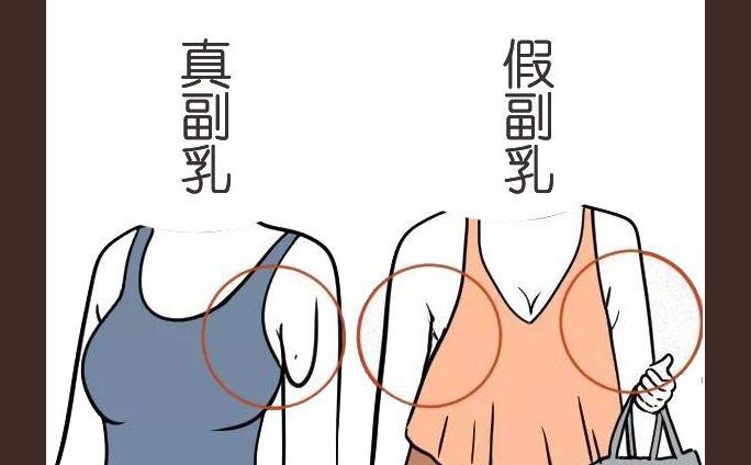 多乳症什么症状？多乳症怎么治疗？