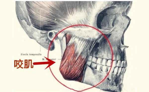 瘦咬肌有哪些方法？瘦脸针多少钱打一针？
