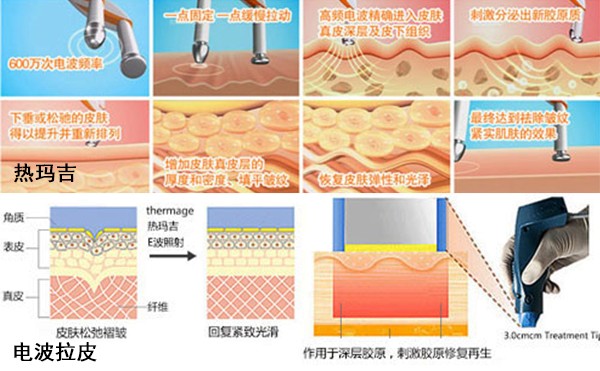 电波拉皮和热玛吉有什么区别？哪个抗衰效果好？