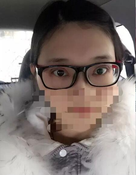 北京京民双眼皮修复案例分享，说是妈生眼我都信
