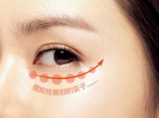 上海新健威医疗美容门诊部激光祛眼袋