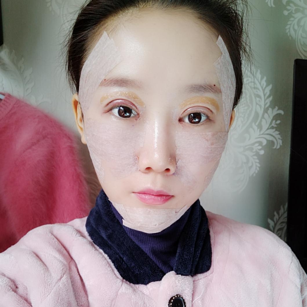 上海首尔丽格整形医院医生唐鏖做眼综合+自体脂肪全脸填充案例效果对比图