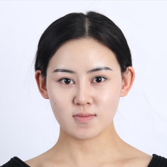 上海时光整形外科医院医生李静林做假体隆鼻和反颌手术怎么样？