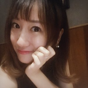 蚌埠韩美美莱整形做玻尿酸面部除皱效果怎么样？附陈泽医生案例效果图