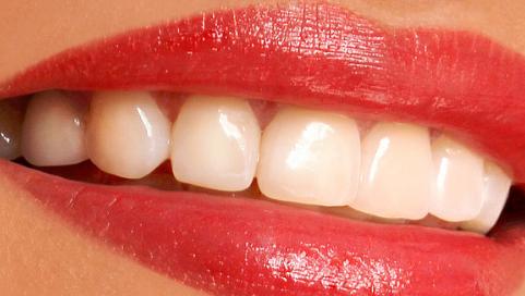 牙齿美容冠一般多少钱？是按牙齿算的吗？