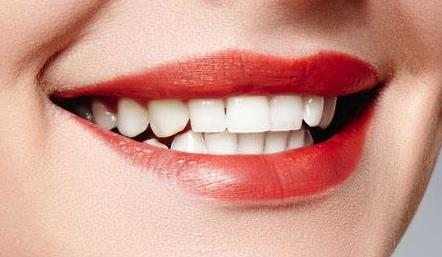 牙齿矫正怎么做？手术效果如何？