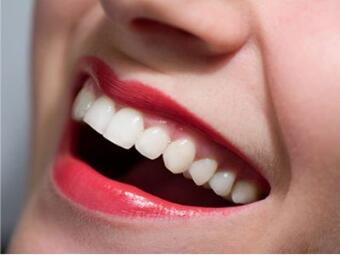 冷光美白牙齿能持续多久？