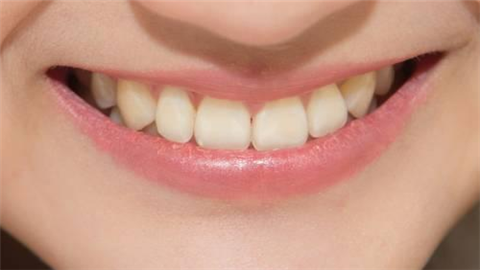 牙齿矫正后遗症有哪些？对后期有什么影响？