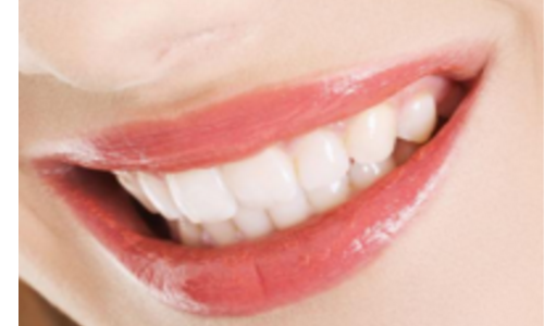 牙齿矫正对以后有什么影响？