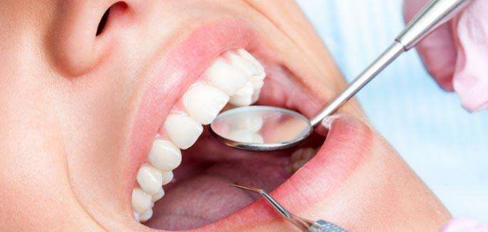 树脂贴面牙齿能保持多久？一颗牙需要多少钱？