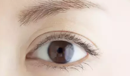 做双眼皮的效果如何？