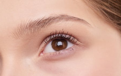 双眼皮的恢复期是多久？