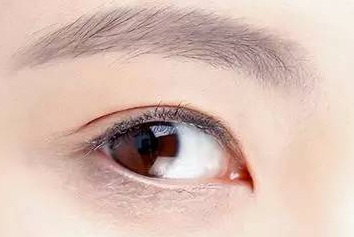 开眼角割双眼皮安全吗？开眼角能保持多久？