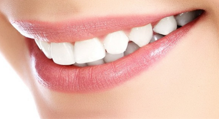 成都牙齿矫正医院哪几家效果好？前十榜单为您推荐！