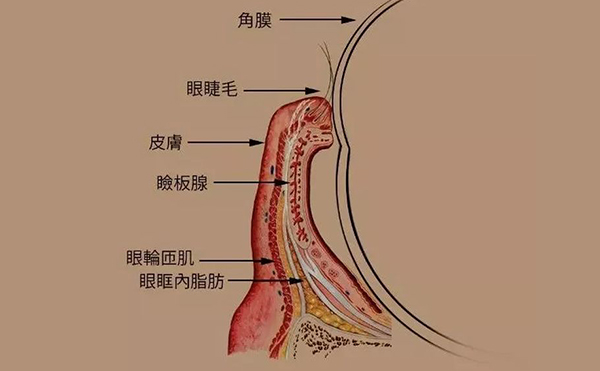 眼睑内翻手术成功率多少?眼睑内翻手术后遗症有哪些?