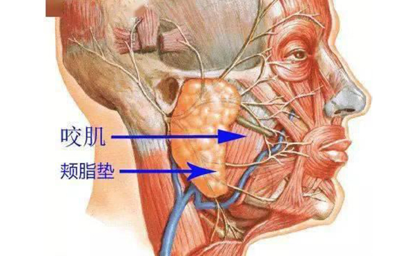 面部吸脂和取颊脂垫有什么区别?哪个效果好?