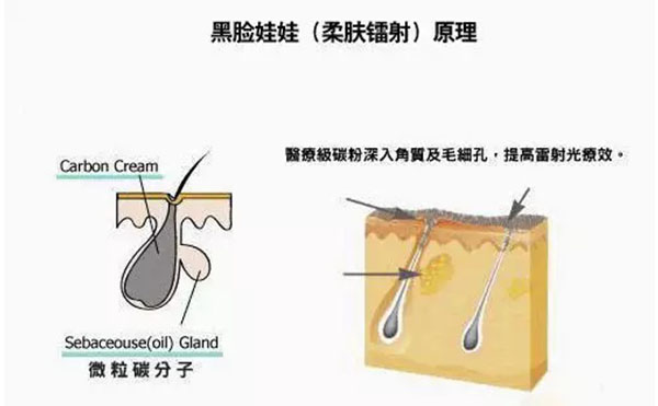 黑脸娃娃是什么？