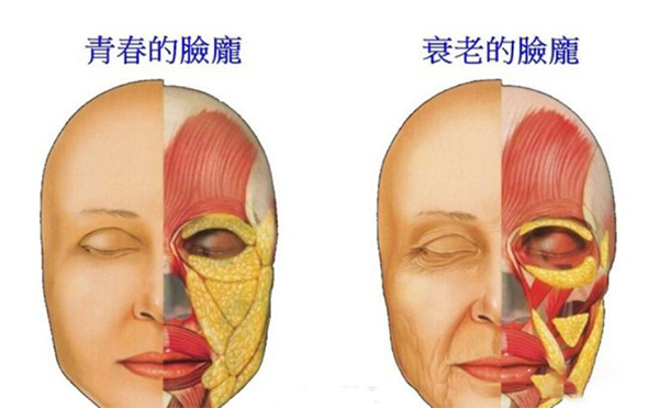 电波拉皮的误区？