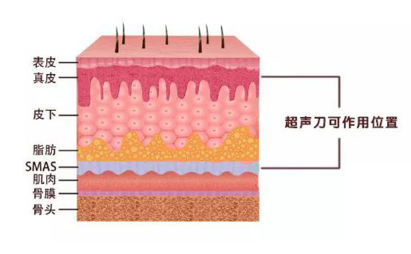 超声刀有什么副作用?后果严重吗?