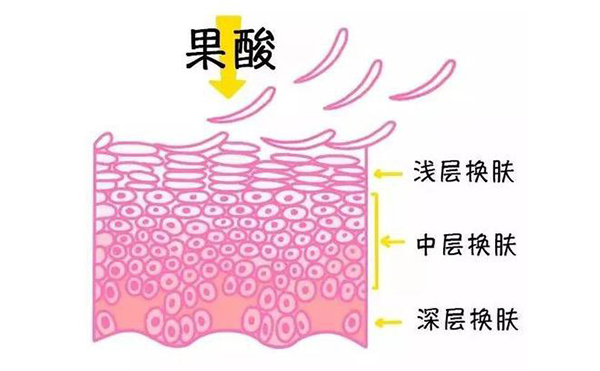 果酸焕肤的作用有哪些？