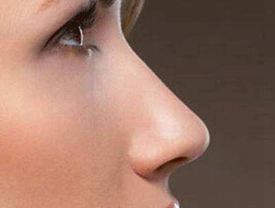 鼻中隔软骨隆鼻有哪些优缺点？鼻中隔软骨隆鼻能维持多久？