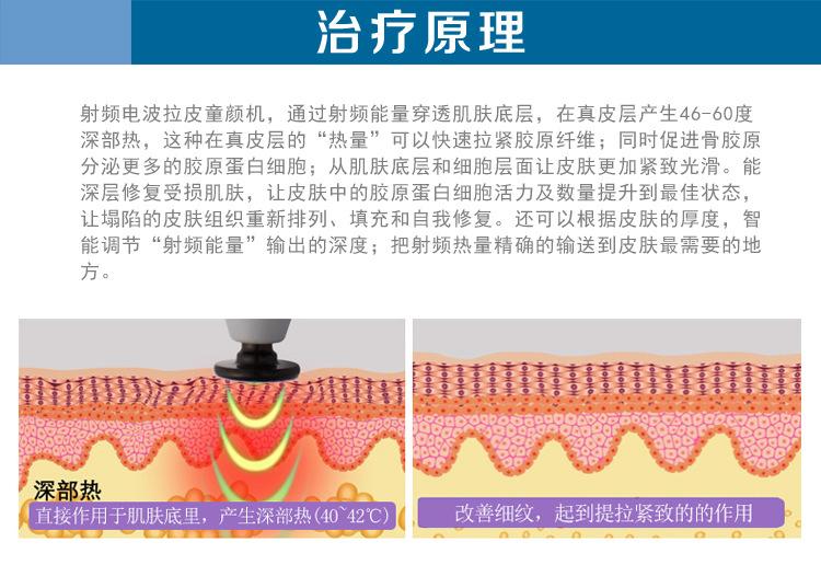  射频紧肤的效果到底怎么样呢？射频紧肤多久做一次？