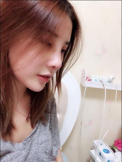 上海艺星医疗美容医院做鼻综合术后的日常恢复情况