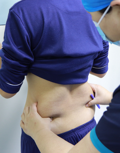 武汉米兰医疗美容门诊部做全身吸脂手术前的腰部